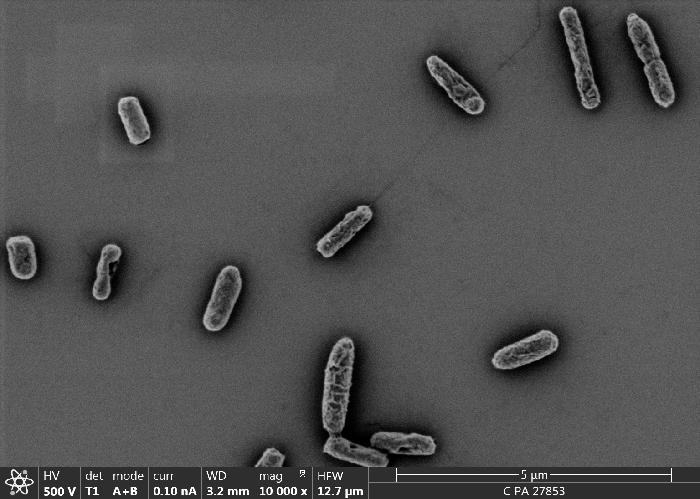 Imagen de bacterias sobre recubrimientos solgel después de un test de adhesión in vitro