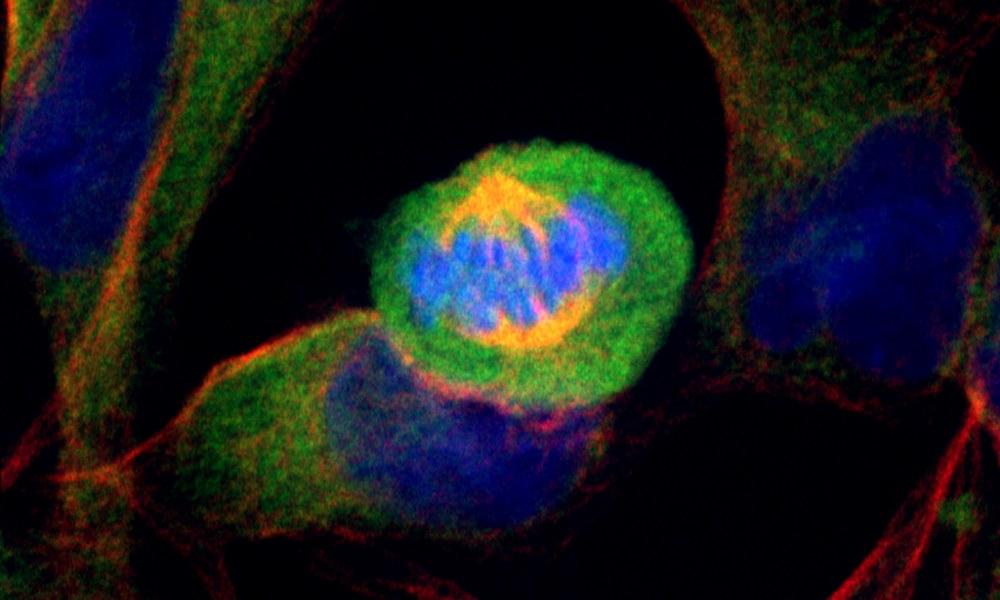 El color azul indican los cromosomas en una celula en division celular siendo transportados por los microtubulos (amarillo). El citoplasma en color verde. Crédito Imagen capturada por Ander Bastida Urkiza / UC3M