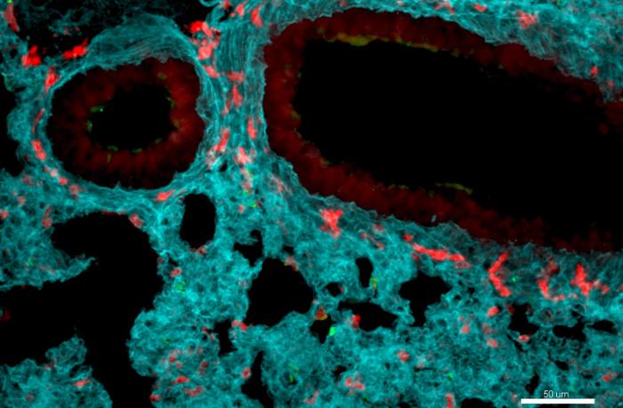 Sobre fondo azul, imagen de microscopio: Neutrófilos se acumulan en los alvéolos de un pulmón infectado con gripe.